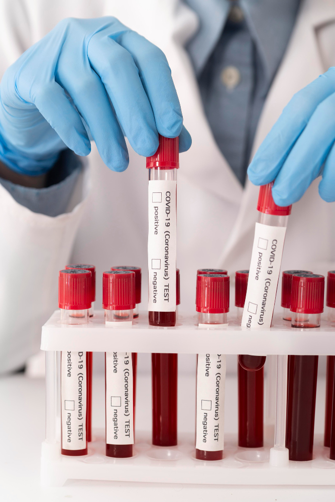 Blood Group B