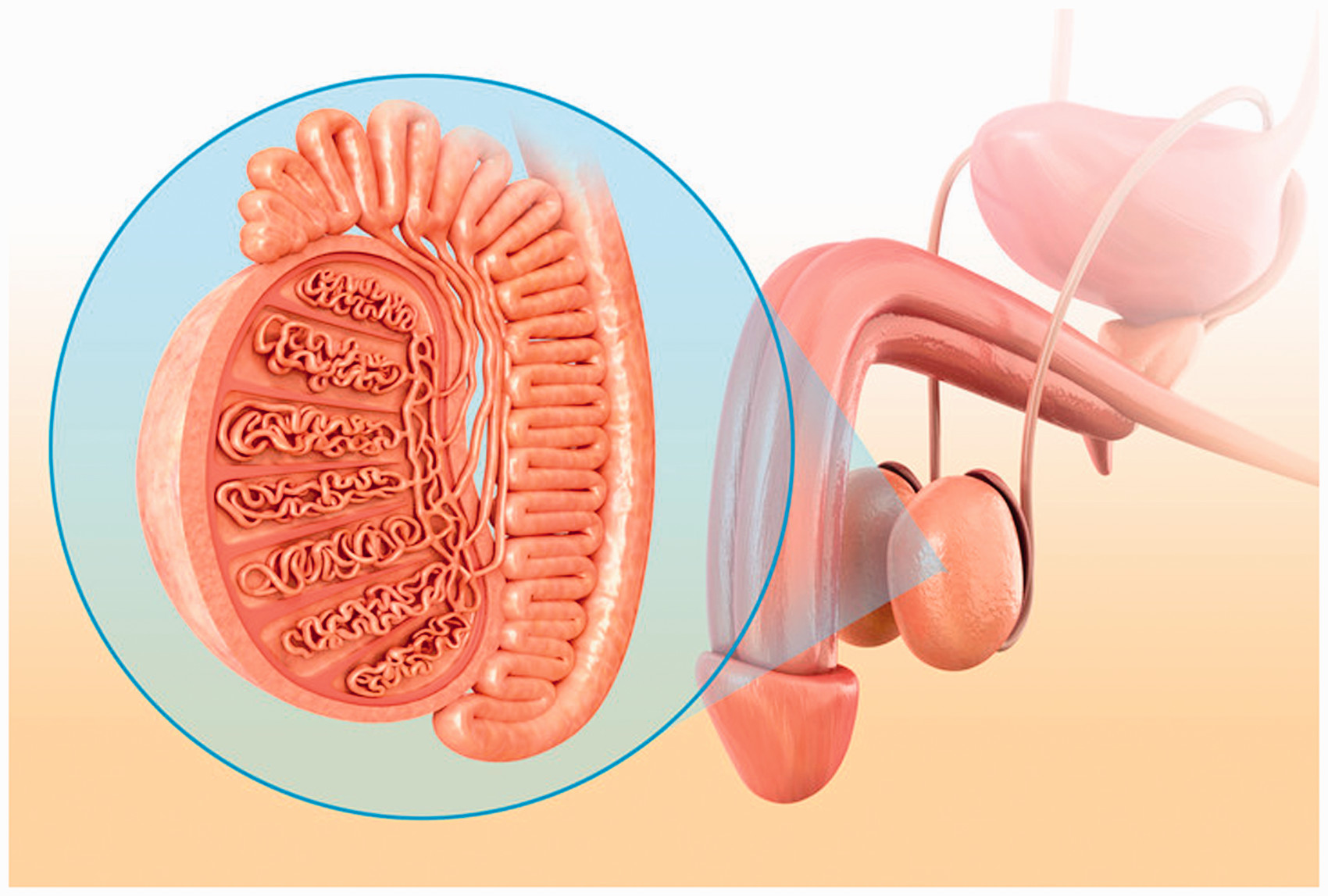 Epididymitis